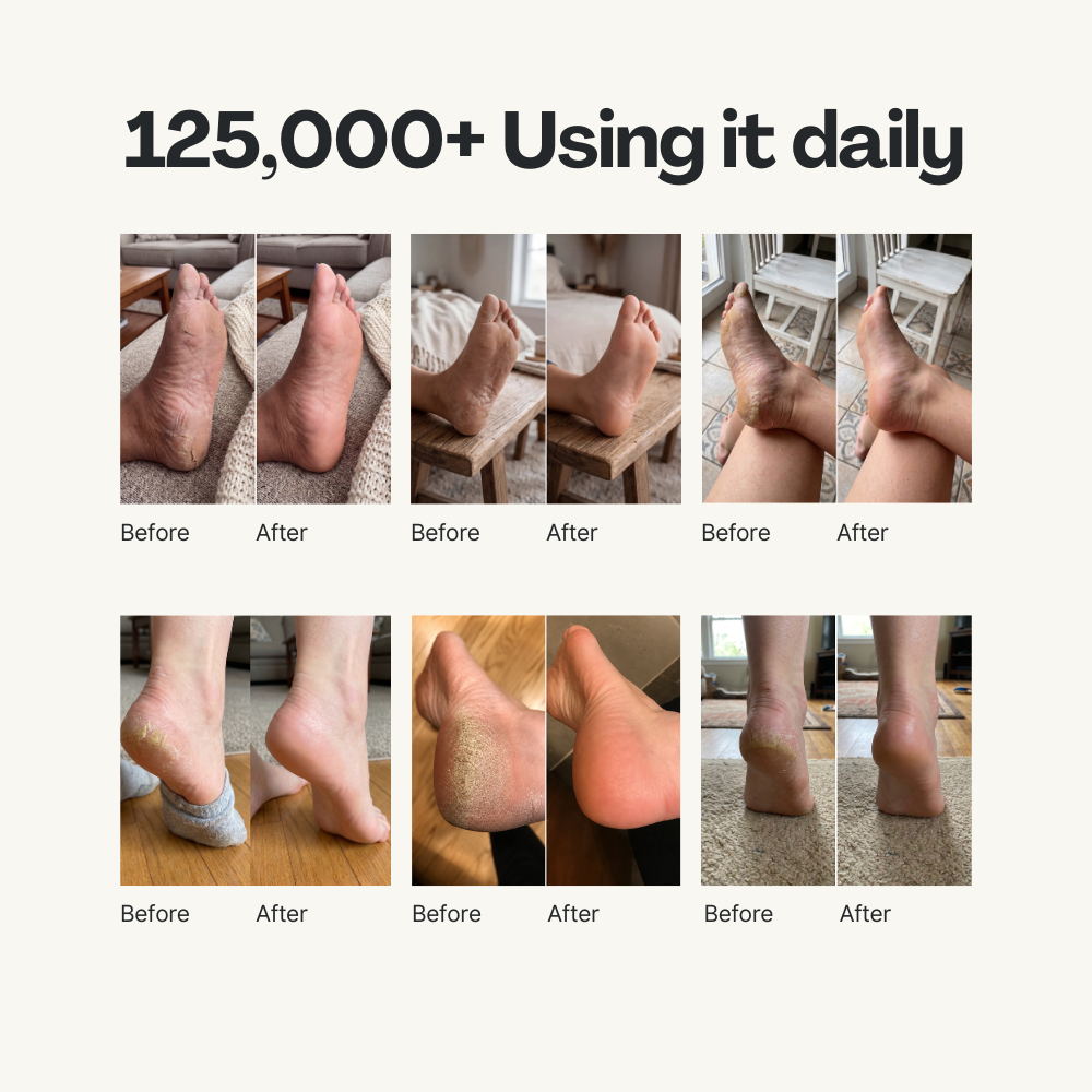 Deep-Repair Heel Balm