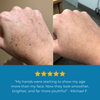 Nuriden™ Age Spot Cream