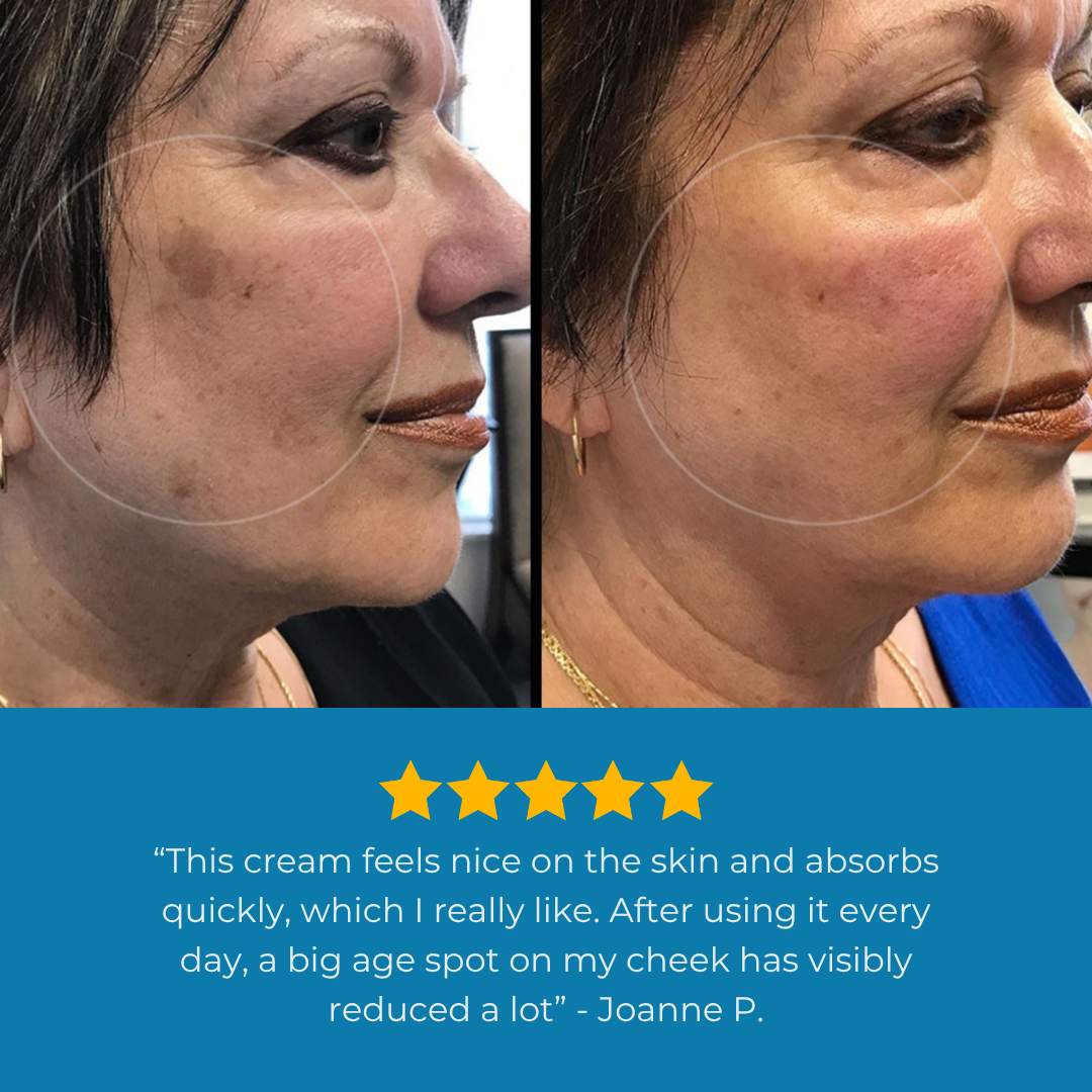 Nuriden™ Age Spot Cream