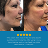 Nuriden™ Age Spot Cream